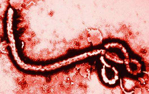 反滲透超純水機(jī)在生物病毒研究上的作用